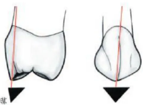 Figure 9 : La cuspide secondaire présente des formes peu convexes, plus saillantes [13] 