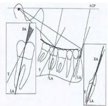 Figure 26 : Loi des tangentes , Présence d’une différence d’angle (DA) entre l’axe idéal selon la loi 