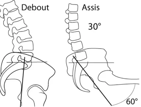 Fig. 2 : Assis, un angle de 90° entre le tronc et la cuisse, peut être réparti entre 30° de 