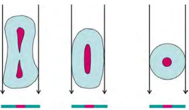 Fig. 6 - Les limites de la radiographie en deux dimensions : la projection de ces trois 