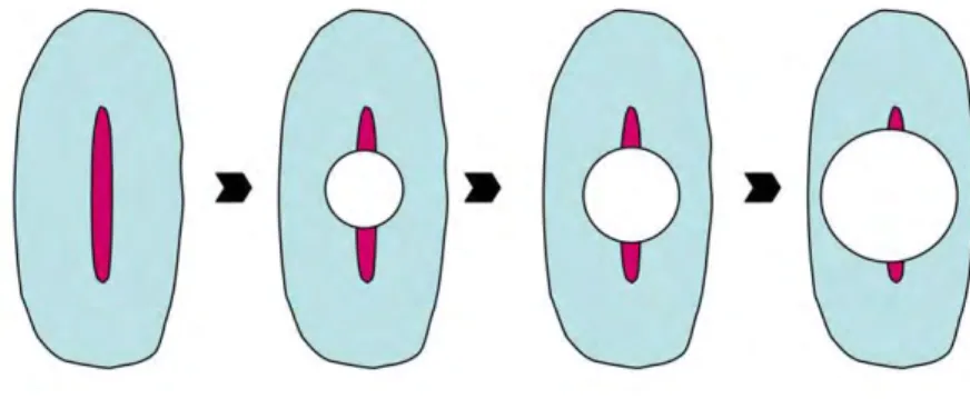Fig. 18 – Schéma illustrant la préparation d’un canal « long-ovale » avec un système de 