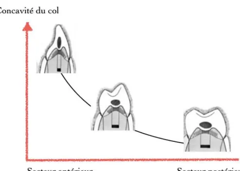 Figure 3 - Anatomie du col en fonction du secteur dentaire, images issues de  Genon et coll.2005