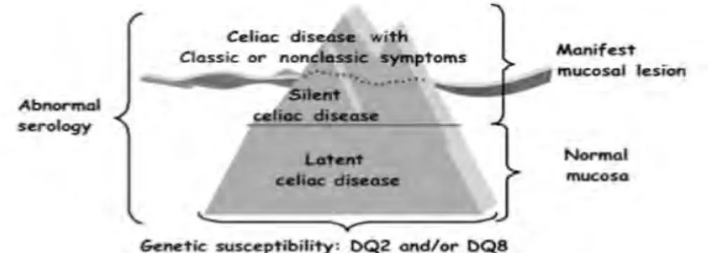 Figure 1 : Modèle de l’iceberg proposé pour la maladie cœliaque d’après Ferguson et al 