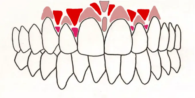 Figure 3 - Schéma représentant le dessin des papilles 