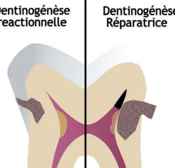 Figure 1 : Différence entre la dentinogénèse réactionnelle et la dentinogénèse  réparatrice 102