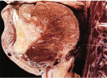 Figure	
  12	
  :	
  Pièce	
  anatomique	
  montrant	
  la	
  fragilité	
  osseuse	
  au	
  niveau	
  de	
  l'incisive	
  mandibulaire	
  (25)	
  