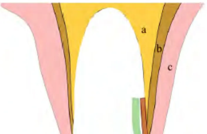 Figure 18 : Vue proximale schématique de la position du fragment  retenu (en vert) dans l’alvéole