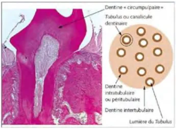 Figure 4 : Dentine circumpulpaire 