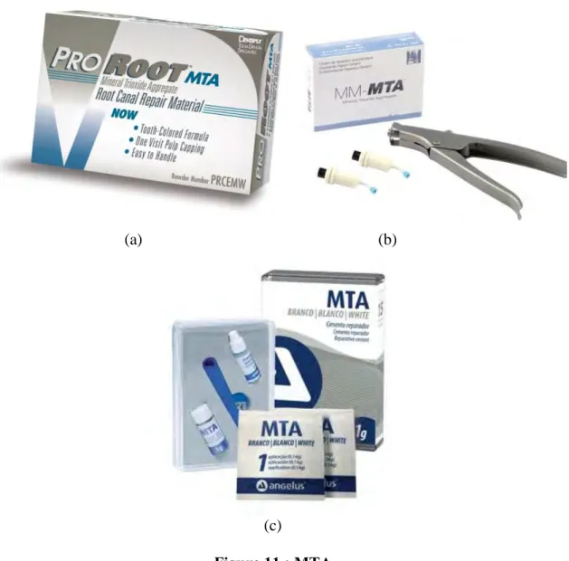 Figure 11 : MTA 