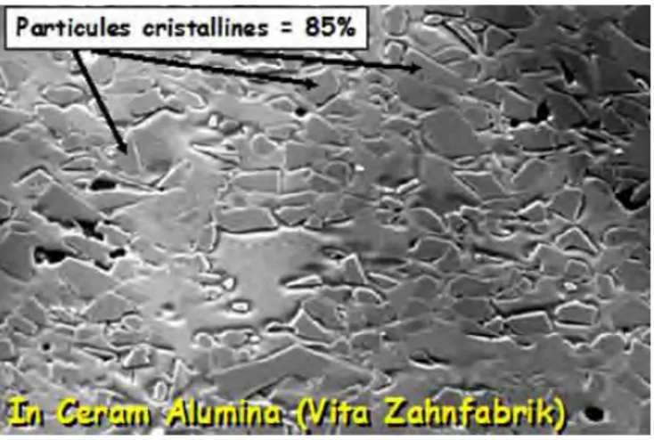 Figure 19 : microphotographie en MEB d’un échantillon de céramique alumineuse à haute teneur  en particules cristallines et verre infiltré  [14]