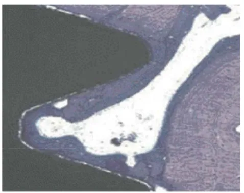 Fig 28a : Implant à surface  machinée à 3 semaines. L’os  néoformé entre en contact ponctuel  avec la surface implantaire 