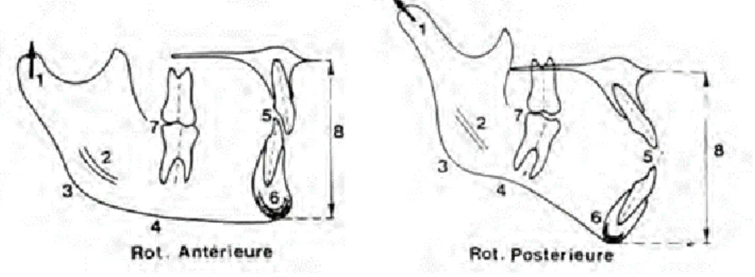 Figure 8 : Schéma des rotations mandibulaires selon Bjork (23)  