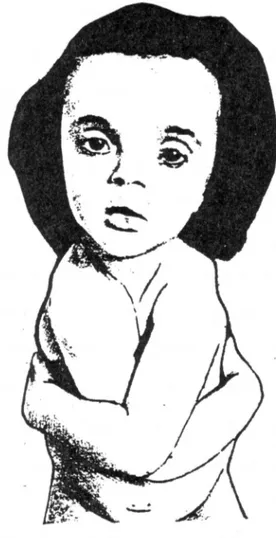 Figure 8- Photographie de Maroteaux (1972).