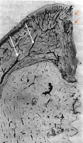 Figure 8: Rameaux sous périostés (flèches blanches) assurant la vascularisation des tissus mous péri- péri-implantaires