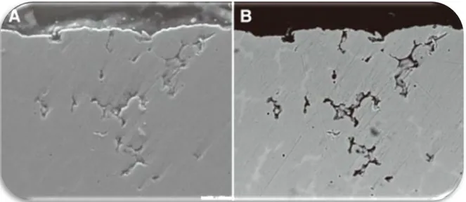 Figure 3 Porosités internes de l'alliage de Cobalt-Chrome coulé