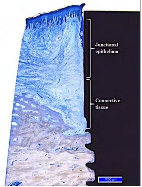 Figure	
  5	
  :	
  Coupe	
  histologique	
  de	
  l'interface	
  tissu-­‐implant.	
  Avec	
  l'accord	
  de	
  P	
  Schupbach.	
  Zurich.	
   Suisse	
  