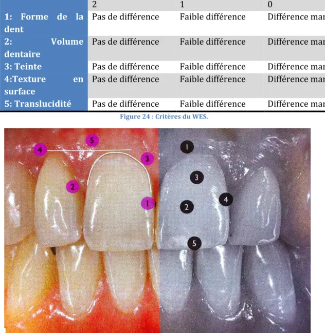 Figure	
  24	
  :	
  Critères	
  du	
  WES.	
  