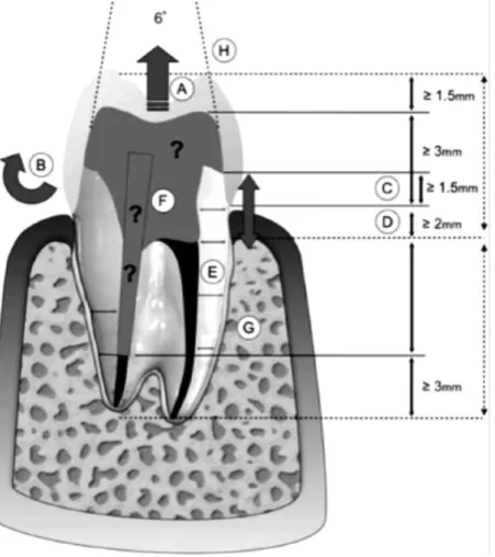 Figure 9 : Paramètres et critères d’évaluation de la dent dévitalisée à prendre en compte pour 