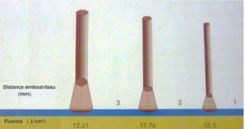 Figure 11 : Influence de la distance laser-tissu cible. Plus le laser s’éloigne, moins la fluence est  importante