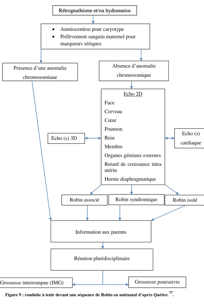 Figure 9 : conduite à tenir devant une séquence de Robin en anténatal d’après Quétier  77 
