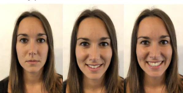 Figure 1. Visage sans sourire à gauche, sourire naturel au milieu, sourire forcé à droite 