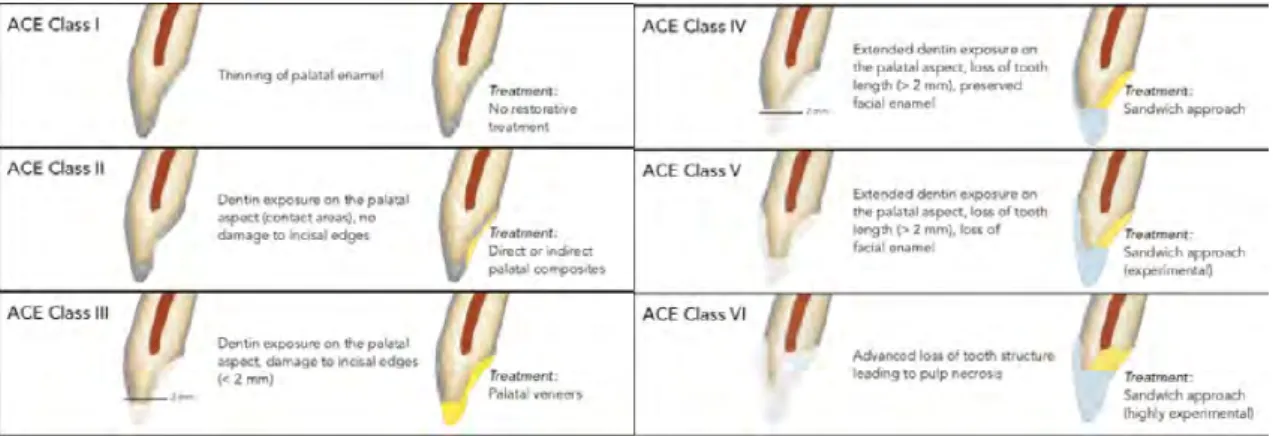 Figure 6. Classification ACE (16) 