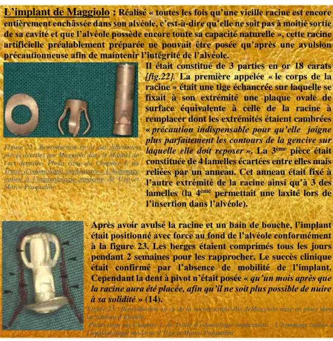 Figure  22 :  Reproduction  en  or  des  différentes  pièces décrites par Maggiolo dans le Manuel de  l'art  dentaire