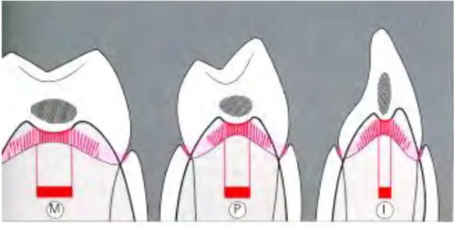 Figure 6 : schéma du septum osseux alvéolaire 