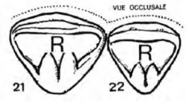 Figure 7 : vue occlusale des incisives centrale et latérale du secteur 2 [4] 