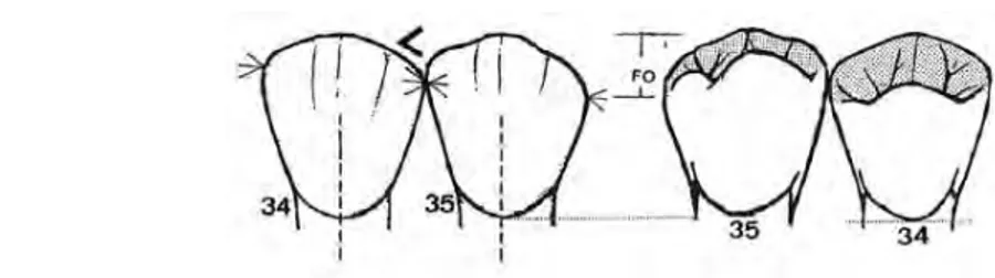 Figure 19 : vues vestibulaires et linguales des prémolaires du secteur 3[4]
