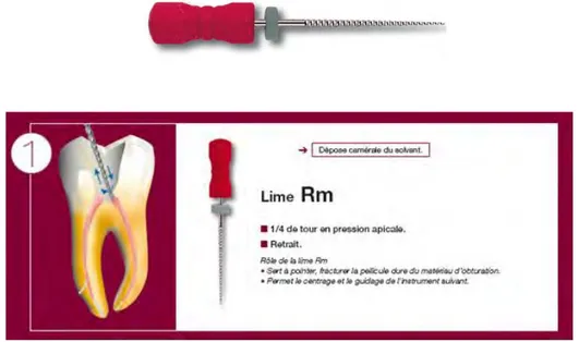 Figure 6 : Lime Rm® du système R-endo® 