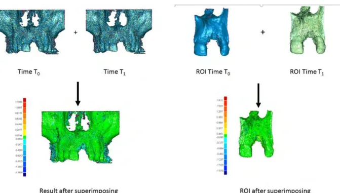 Figure 10 Superposition des données data complètes et de la région d'intérêt (ROI) à T0 et T1