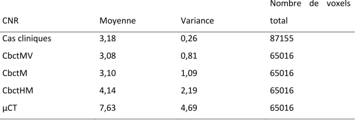 Tableau 1  : Résultats des Acquisitions de données CNR 
