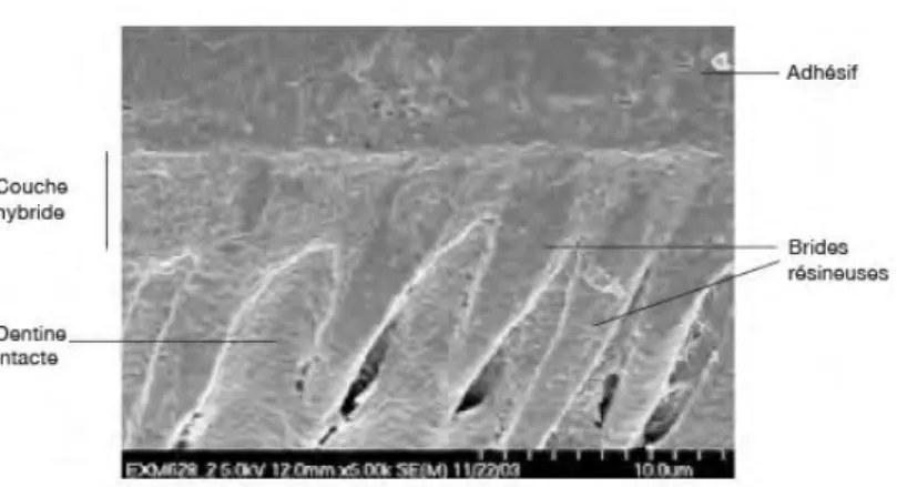 Figure 12 : Coupe montrant la couche hybride ainsi que les  tags de résine 