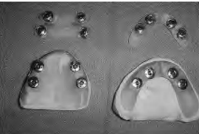 Figure 1 : Porte empreintes fractionnés maxillaire et mandibulaire D'après M.Yenisey et coll