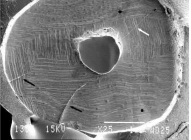 Fig 7: exemples de micro cracks  d’origine ultrasonique.(15) 