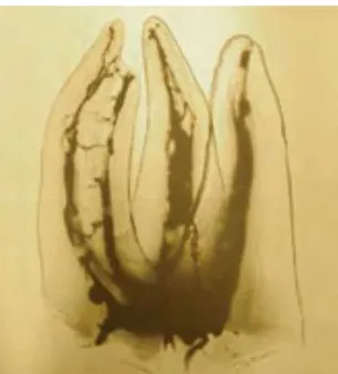 Fig 8 : complexité anatomique de l’endodonte (17) 