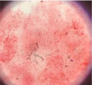 Figure 16 : Coloration de Gram de Fusobacterium nucléatum 