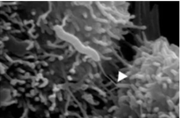 Figure 18 : Campylobacter rectus au microscope électronique, la flèche montre le flagelle  (Nadeem Omar Kaakoush and Hazel Marjory Mitchell, School of Biotechnology and  Biomolecular Sciences, The University of New South Wales, Sydney, NSW, Australia) 