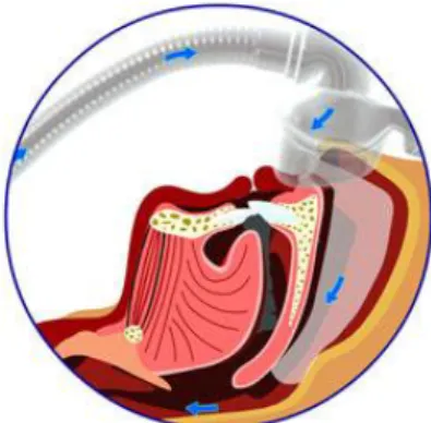 Fig. 7: Principe de fonctionnement de la VPP  [147] 