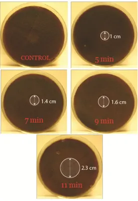 Figure 9 : Plaques de gélose P. gingivalis inoculée au BST. Les temps d'exposition au plasma Pen He et les  diamètres de la zone d'inhibition sont marqués pour chaque plaque