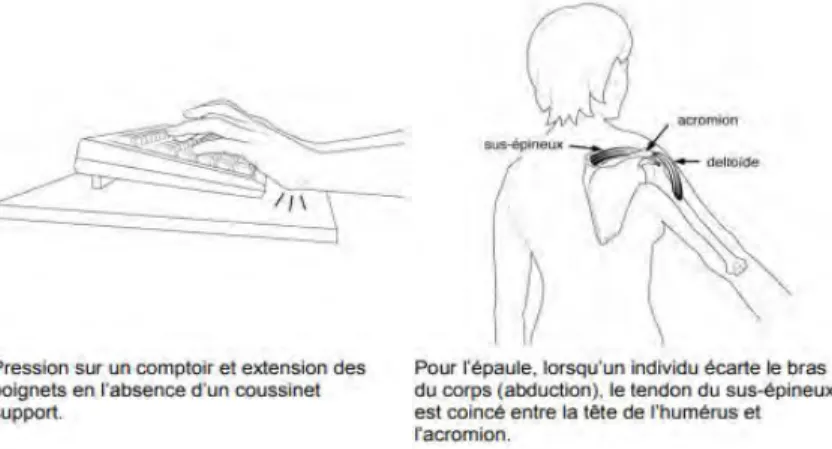 Fig. 20 : Pression d’origine interne et externe [23]  