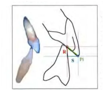 Figure 3 : Schéma de l’angle fonctionnel, du recouvrement vertical et horizontal au niveau des incisives (7) 