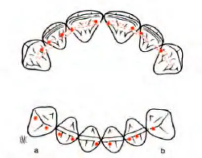 Figure 13 : Contacts entre les bords libres des incisives mandibulaire sur l’arcade antagoniste (5) 