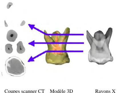 Figure 2 : Coupes horizontales des racines et vue vestibulaire de la première molaire  temporaire maxillaire droite