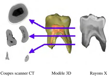 Figure 5 : Coupes horizontales des racines et vue vestibulaire de la première molaire  temporaire mandibulaire droite