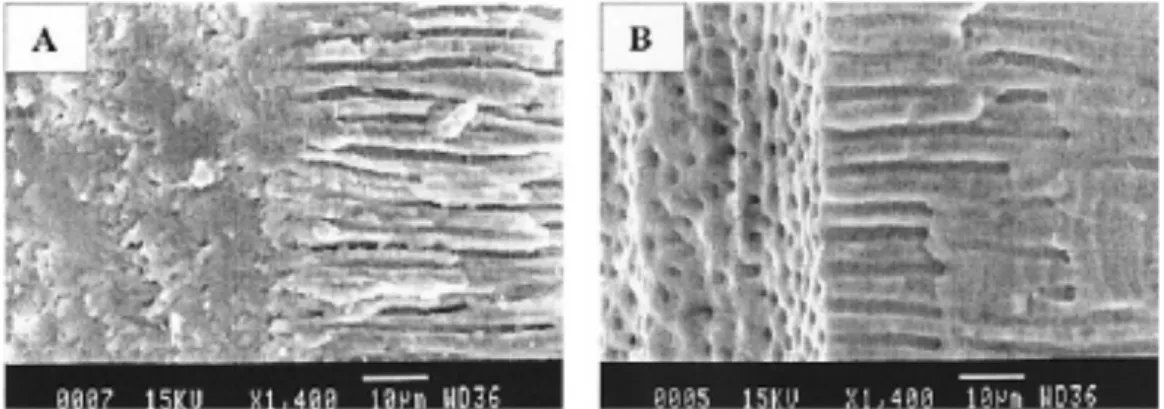 Figure	   6	  : 	   Observation	   au	   microscope	   électronique	   à	   balayage	   de	   l’aspect	   de	   la	   surface	   dentinaire	   avant	   élimination	   de	   la	   smear-­‐layer	   (A)	   et	   après	   élimination	   de	   celle-­‐ci	   par	   des	   solutions	  d’irrigation	  (B),	  Kokkas,	  2004,	   (26) 	  