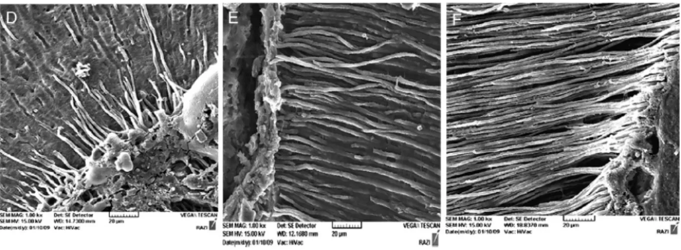 Figure	  7	  : 	   «	  Tags	  »	  de	  ciment	  observés	  au	  microscope	  électronique	  à	  balayage	  (x1000),	  Moradi,	  2009,	  (35)	   	  