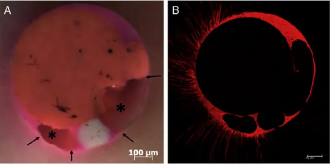 Figure	
   8	
  :	
   Observation	
  à	
  la	
  loupe	
  binoculaire	
  (à	
  gauche)	
  et	
  au	
  microscope	
  confocal	
  (à	
  droite)	
  de	
  la	
  section	
   transversale	
   d’un	
   canal	
   obturé	
   par	
   condensation	
   latérale.	
   Deux	
   vides	
   sont	
   mis	
   en	
   évidence	
   (*)	
   	
   ainsi	
   que	
   plusieurs	
  lacunes	
  à	
  l’interface	
  ciment/dentine.	
  Marciano,	
  2011,	
  	
  