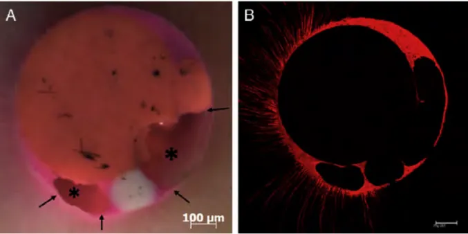 Figure	   8	  :	   Observation	  à	  la	  loupe	  binoculaire	  (à	  gauche)	  et	  au	  microscope	  confocal	  (à	  droite)	  de	  la	  section	   transversale	   d’un	   canal	   obturé	   par	   condensation	   latérale.	   Deux	   vides	   sont	   mis	   en	   évidence	   (*)	   	   ainsi	   que	   plusieurs	  lacunes	  à	  l’interface	  ciment/dentine.	  Marciano,	  2011,	  	  